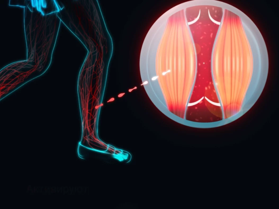 Как стельки могут помочь при лечении варикоза вен на ногах?