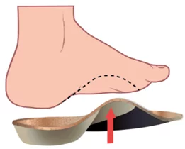 Ортопедические стельки для профилактики плоскостопия и других деформаций стоп