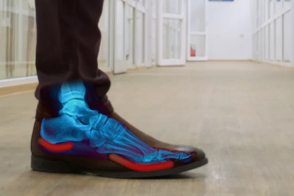 Ортопедические стельки при усталости в ногах из ecoflex SB-07 SB-08