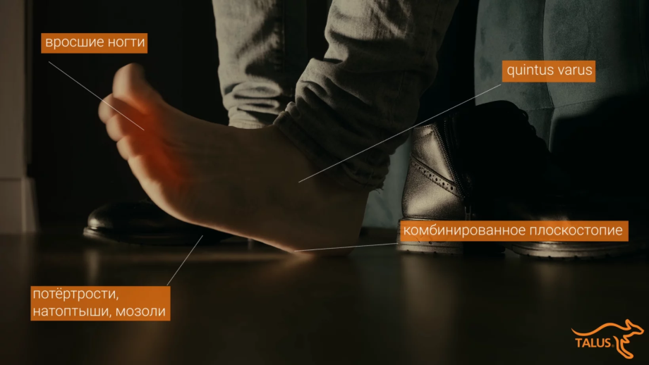 Как лечить «косточку»?