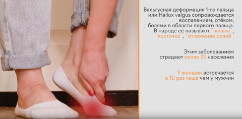 Видеообзор ортопедических стелек Talus "Бабочка"