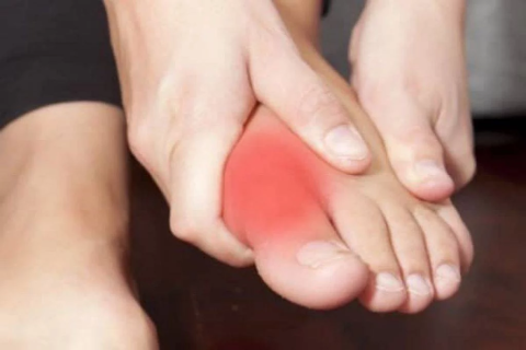 Болит большой палец. Причина – поперечное плоскостопие?