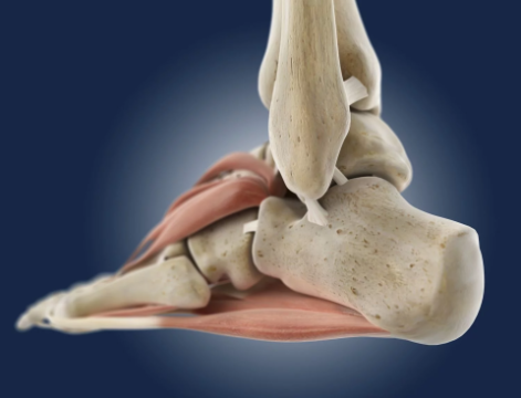 Почему болит пятка?